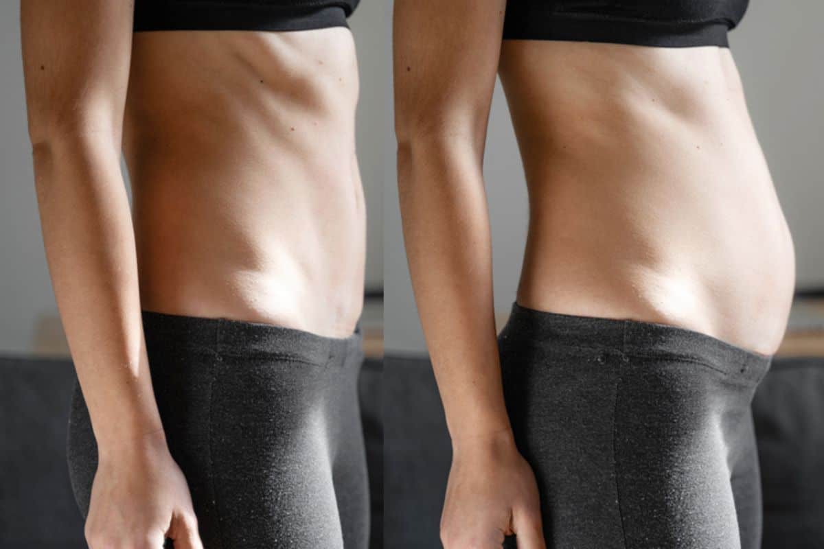 How long does diastasis recti take to improve Greater London (Richmond upon Thames)?
