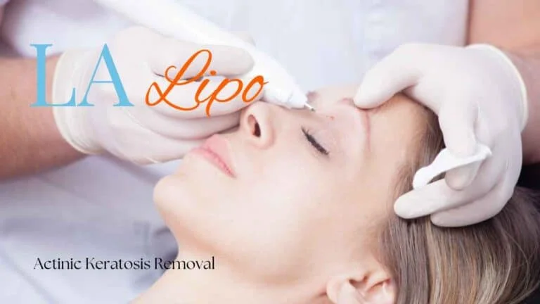Woman receiving Actinic Keratosis Removal Treatment Greater London (Richmond upon Thames)
