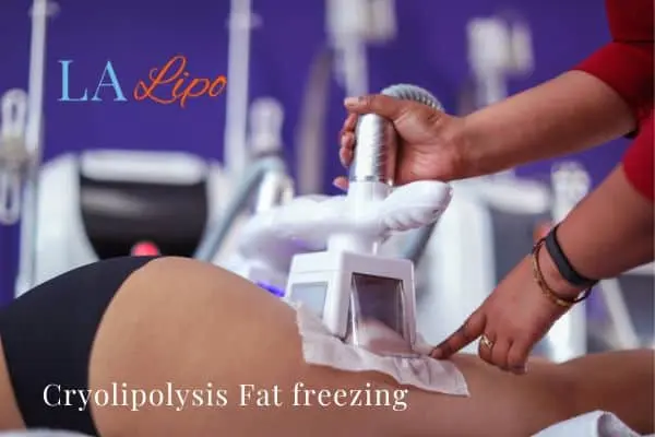 women getting fat freezing Greater London (Richmond upon Thames)