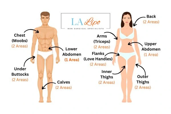 LA LIPO Cryolipolysis Areas Greater London (Richmond upon Thames)