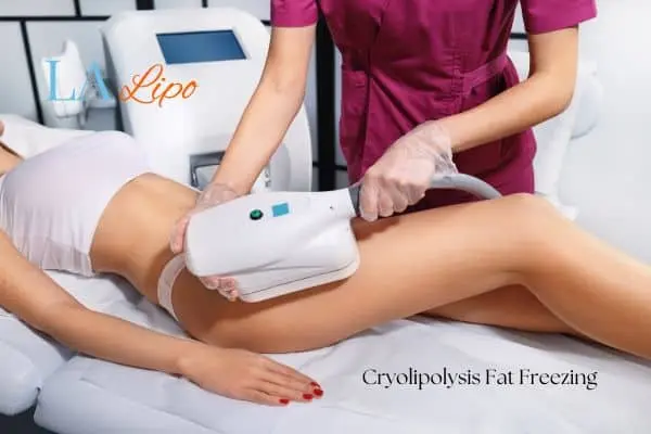 Woman receiving coolsculpting Greater London (Richmond upon Thames) treatment on her thighs
