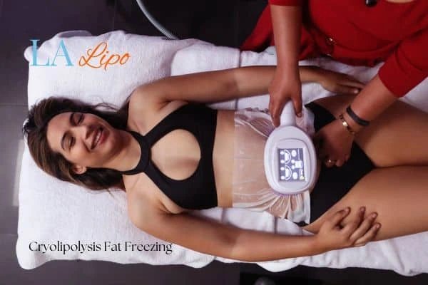 woman getting cryolipolysis Greater London (Richmond upon Thames)