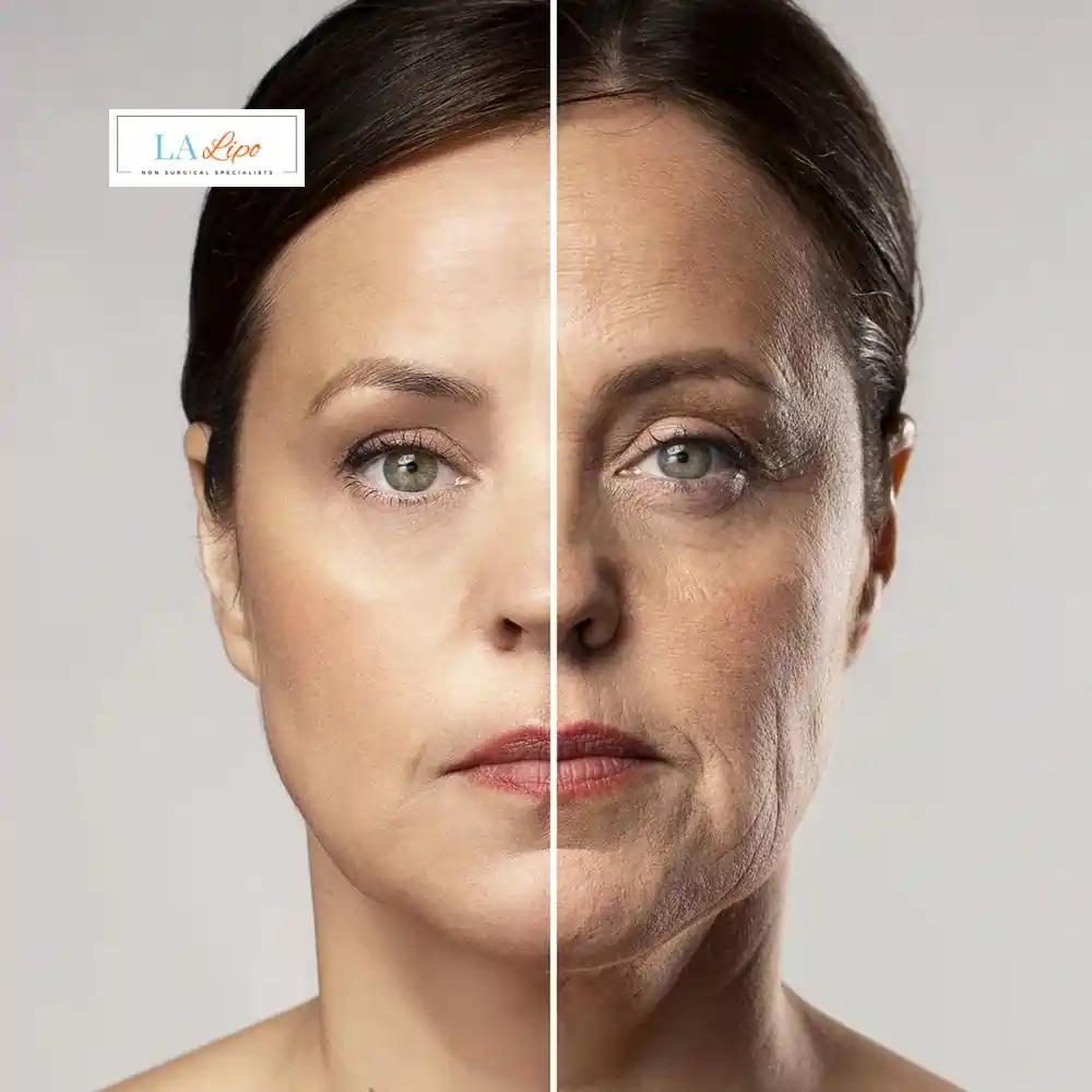 How Can You Tell If Non-Surgical Skin Tightening Is Right for You Greater London (Richmond upon Thames)?