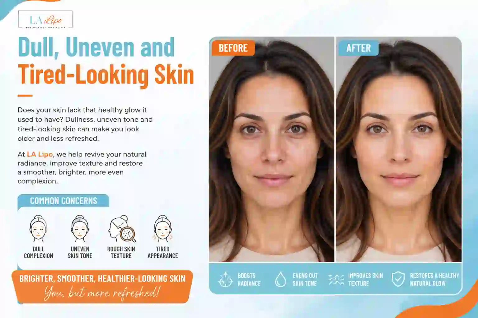 Sign #5: Dull, Uneven and Tired-Looking Skin Greater London (Richmond upon Thames)
