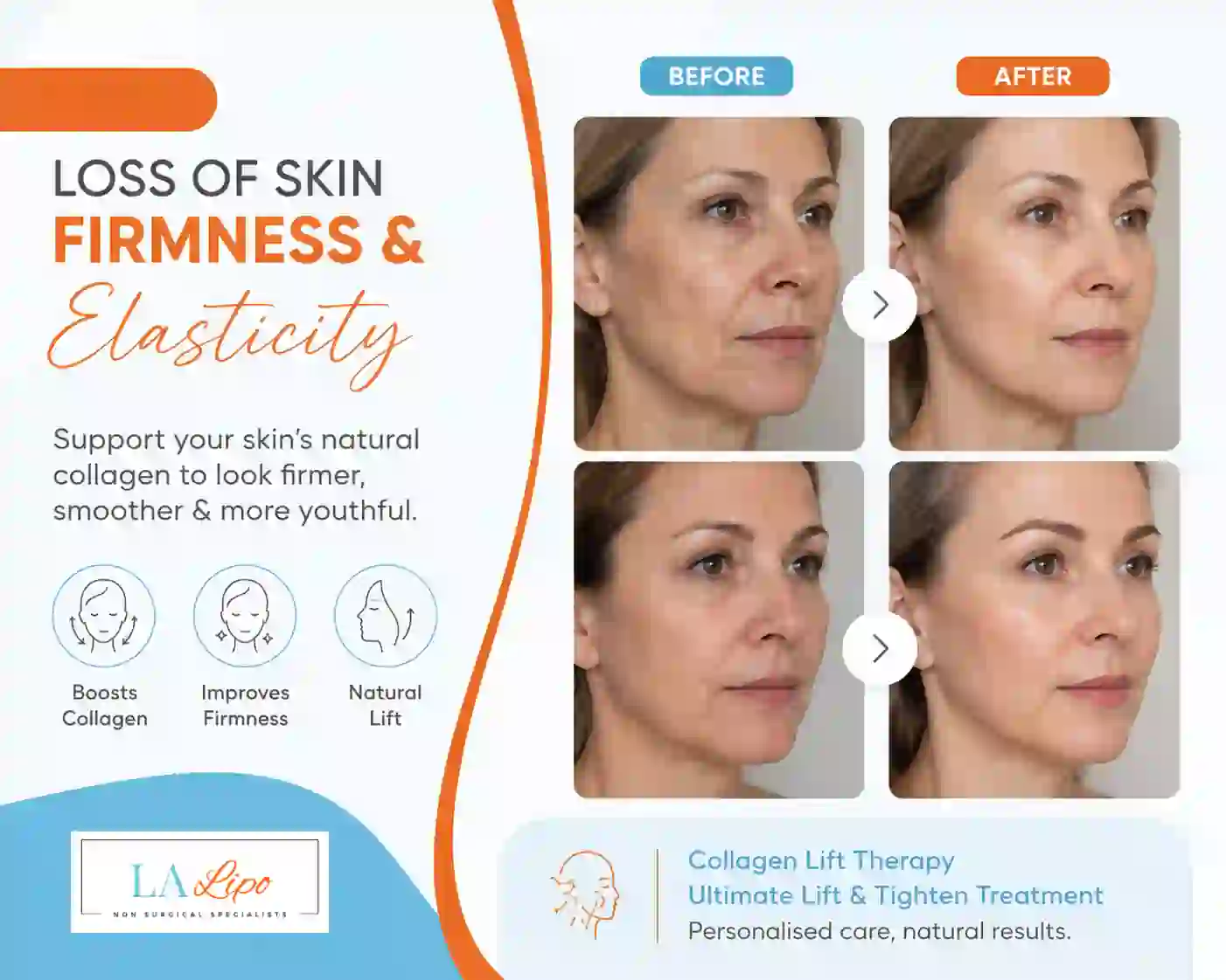 Sign #7: Loss of Skin Firmness and Elasticity Greater London (Richmond upon Thames)
