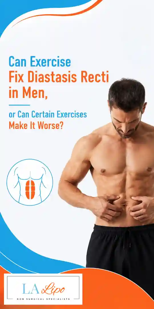 Can Exercise Fix Diastasis Recti in Men, or Can Certain Exercises Make It Worse Greater London (Richmond upon Thames)?