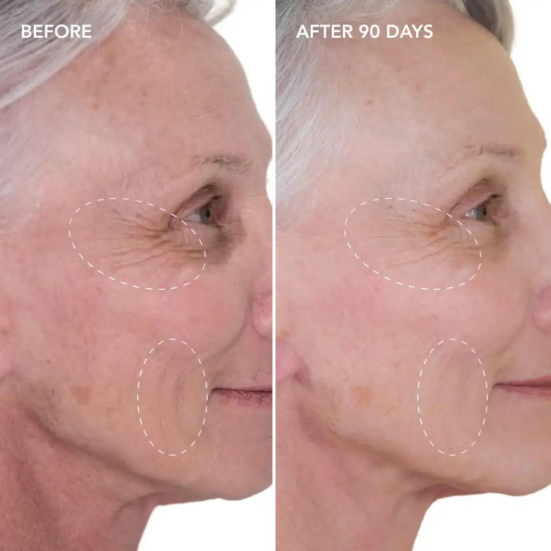 When will you see results Greater London (Richmond upon Thames)